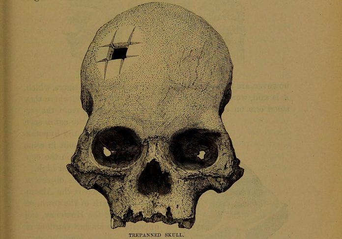foto-2-o-cranio-em-ilustracao-no-livro-de-squier-peca-data-entre-1400-e-1530-d.c.